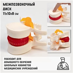 Макет "Межпозвоночный диск" 11*10*8см